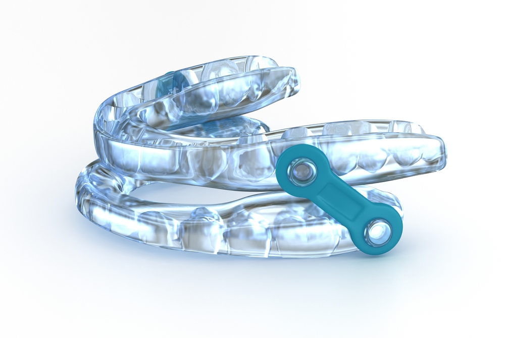 Custom dental sleep appliance